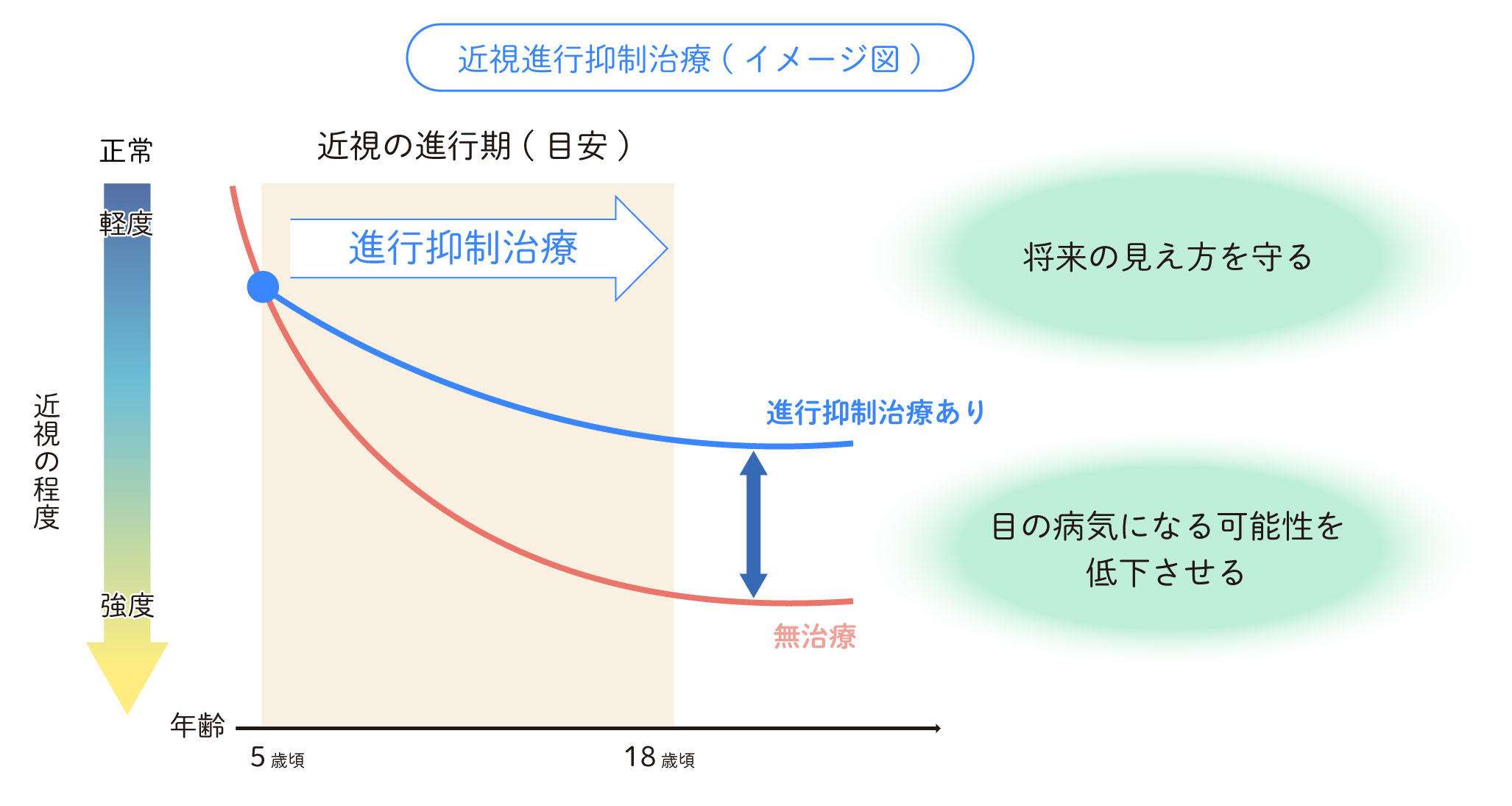 近視