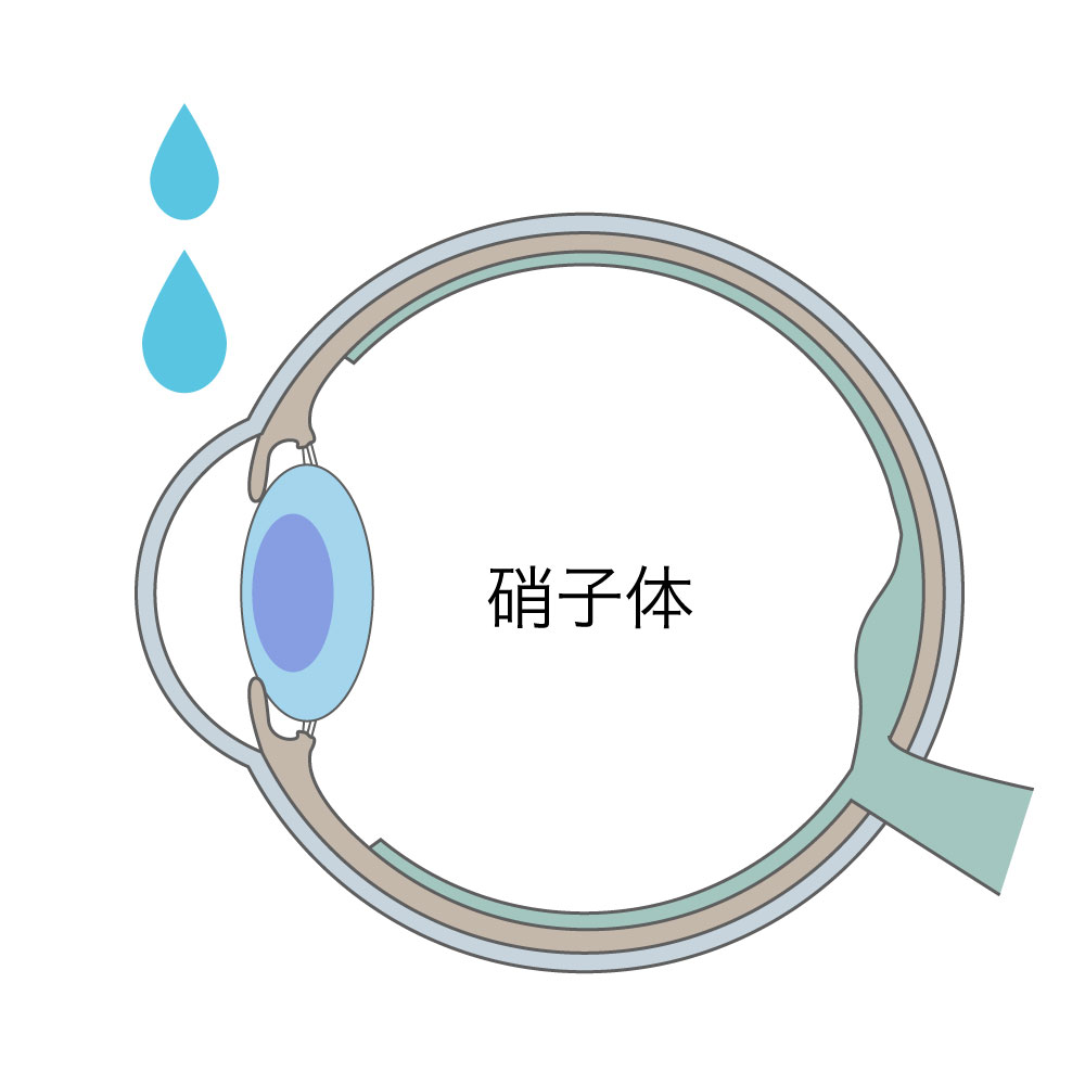 点眼麻酔のイラスト